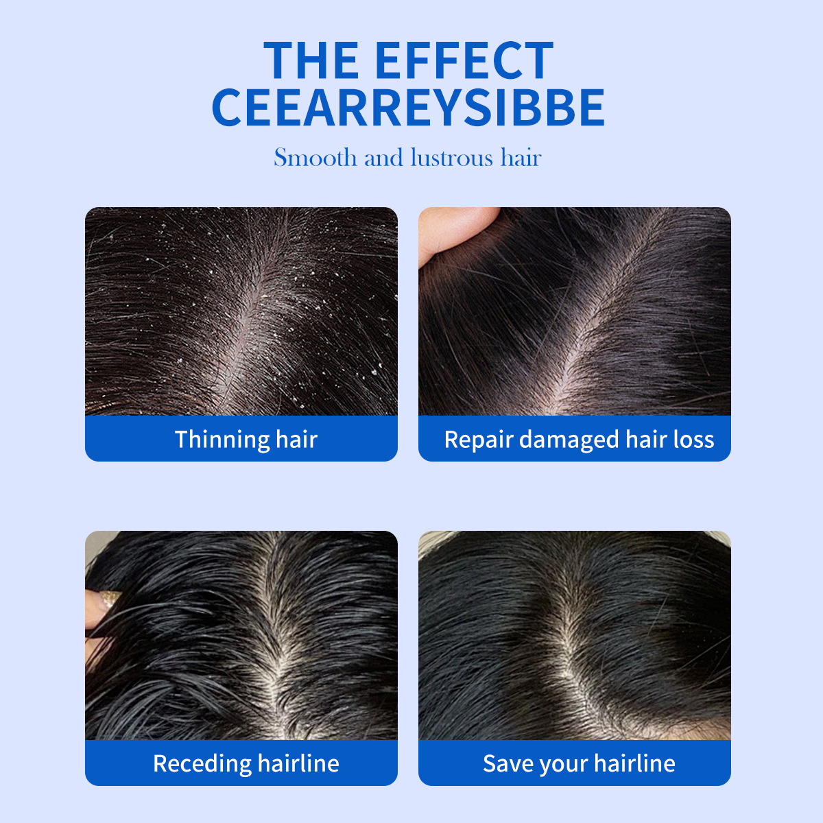 شامبو مضاد للقشرة بثاني كبريتي - مراجعة Hair Care Dandruff وسعره