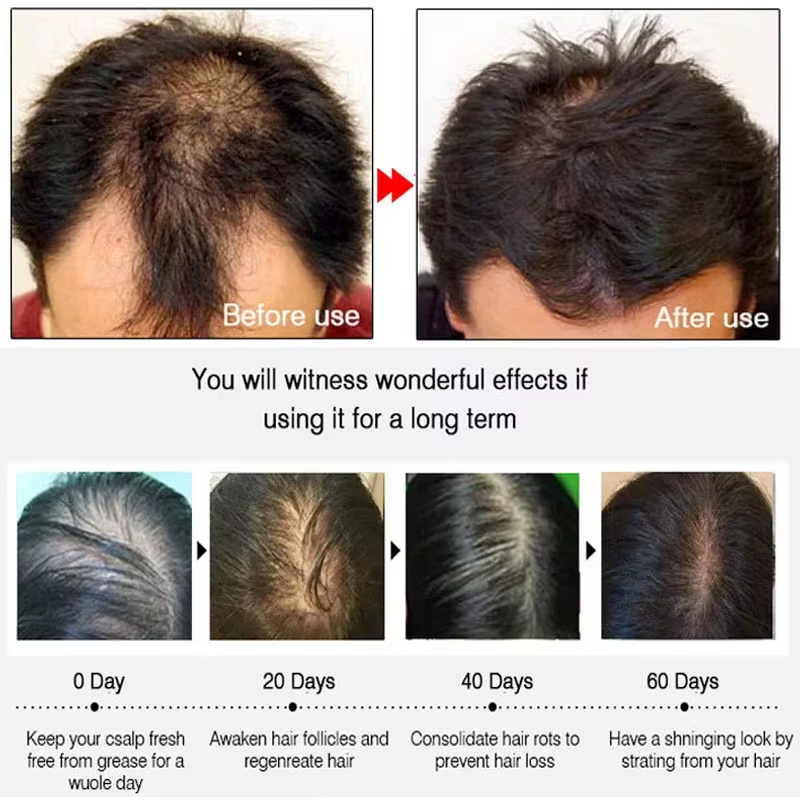 بخاخ الزنجبيل السريع لنمو الشع - مراجعة Hair Care Products وسعره
